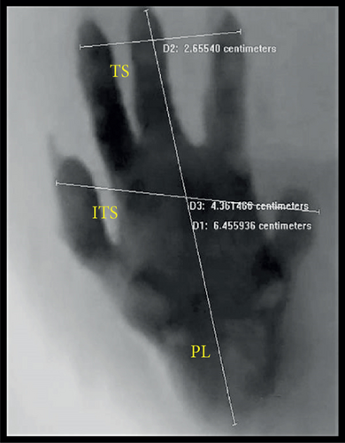 Details are in the caption following the image