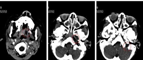 Details are in the caption following the image Details are in the caption following the image