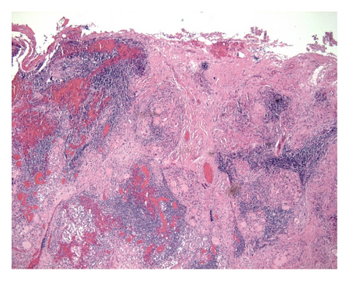 Details are in the caption following the image