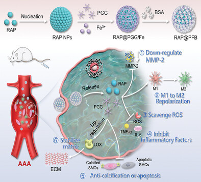 Dual-Drug Nanomedicine Assembly with Synergistic Anti-Aneurysmal Effects via Inflammation Suppression and Extracellular Matrix Stabilization