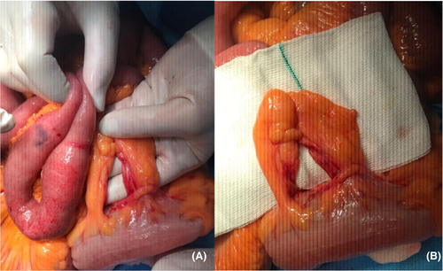 Details are in the caption following the image Details are in the caption following the image