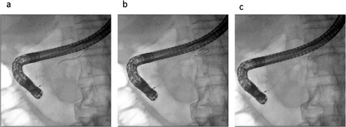 Details are in the caption following the image Details are in the caption following the image
