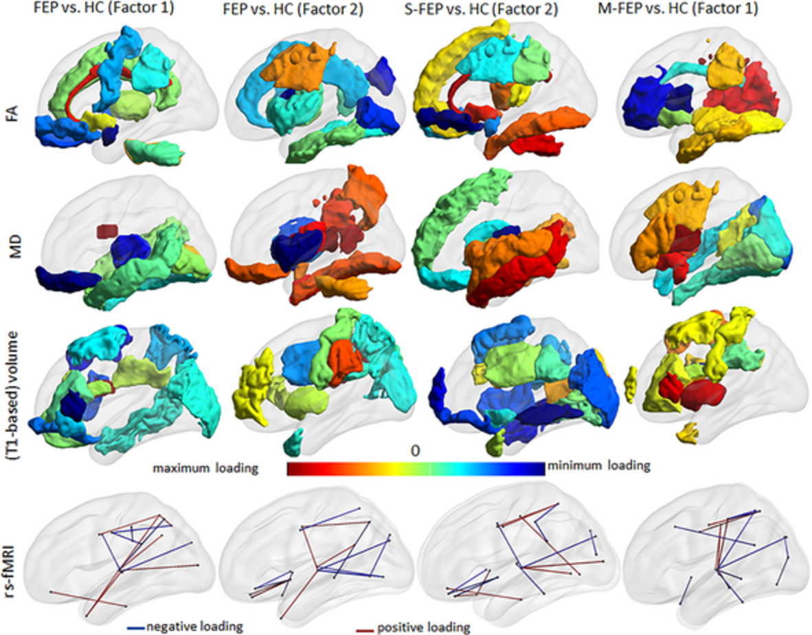Multimodal MRI assessment for first episode psychosis: A major change in the thalamus and an efficient stratification of a subgroup