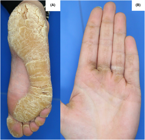 Details are in the caption following the image Details are in the caption following the image