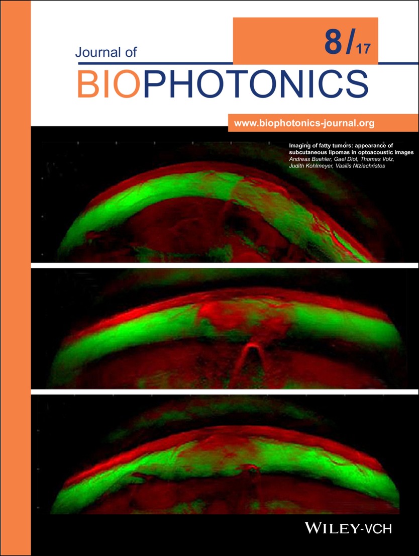 Front Cover: Imaging of fatty tumors: appearance of subcutaneous clipomas in optoacoustic images (J. Biophotonics 8/2017) Volume 10 Issue 8, 2017
