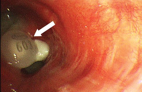Details are in the caption following the image Details are in the caption following the image