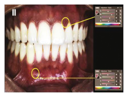 Details are in the caption following the image Details are in the caption following the image