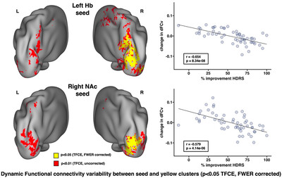 Modulation of habenular and nucleus accumbens functional connectivity by ketamine in major depression