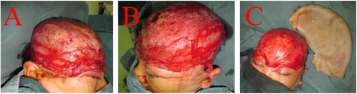 Details are in the caption following the image Details are in the caption following the image