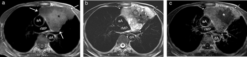 Details are in the caption following the image