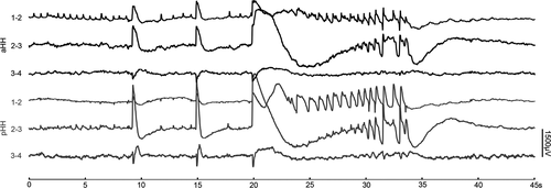 Details are in the caption following the image Details are in the caption following the image