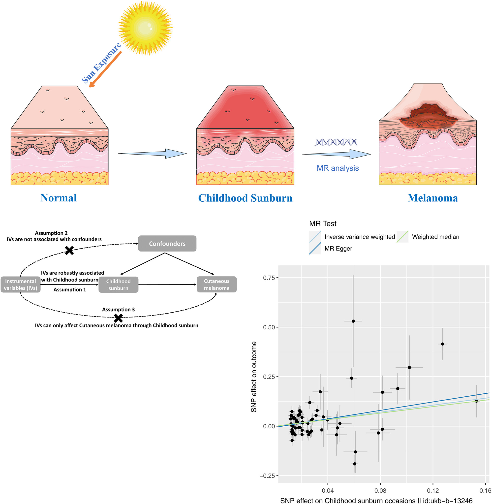 Evaluating the effect of childhood sunburn on the risk of cutaneous melanoma through Mendelian randomization