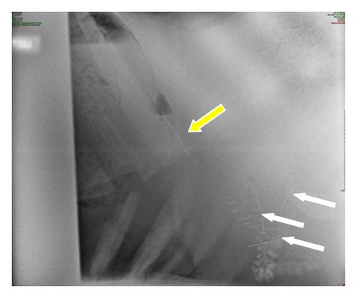 Details are in the caption following the image Details are in the caption following the image