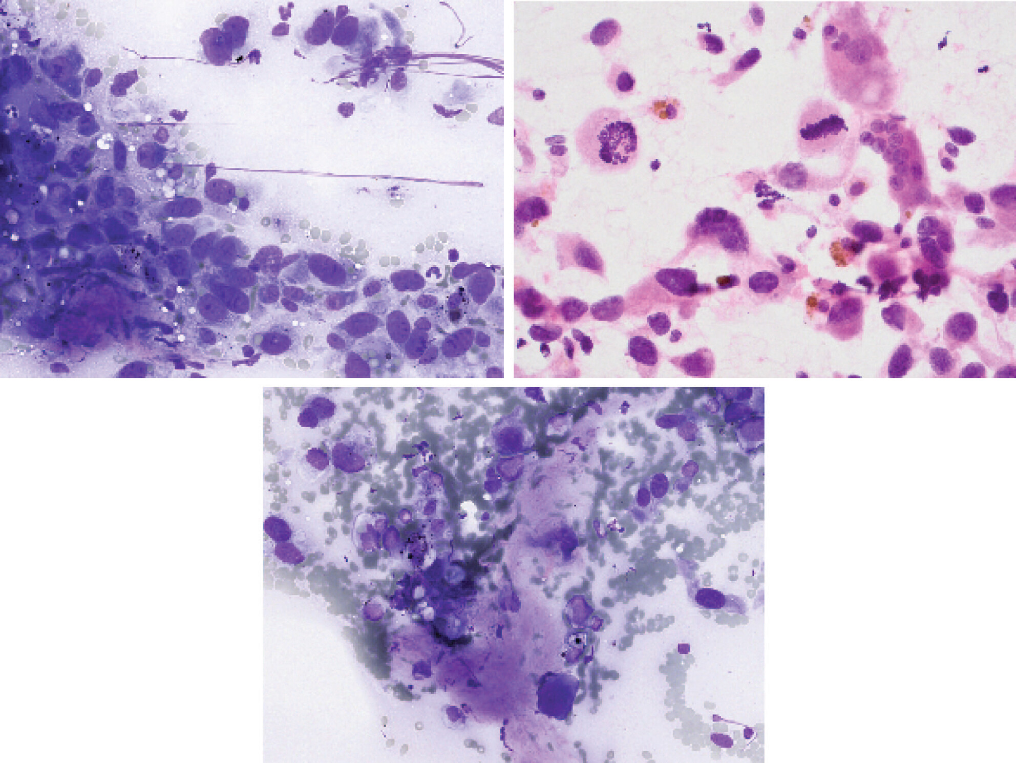 Reporting Bone Cytopathology—A Proposal Based on a Single Tertiary Centre Experience