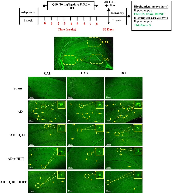 Effects of Pretreatment With Coenzyme Q10 (CoQ10) and High-Intensity Interval Training (HIIT) on FNDC5, Irisin, and BDNF Levels, and Amyloid-Beta (Aβ) Plaque Formation in the Hippocampus of Aβ-Induced Alzheimer's Disease Rats