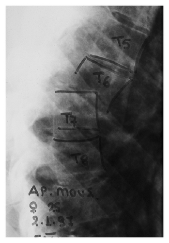 Details are in the caption following the image