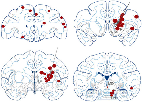 Progression of phosphorylated α-synuclein in Macaca fuscata