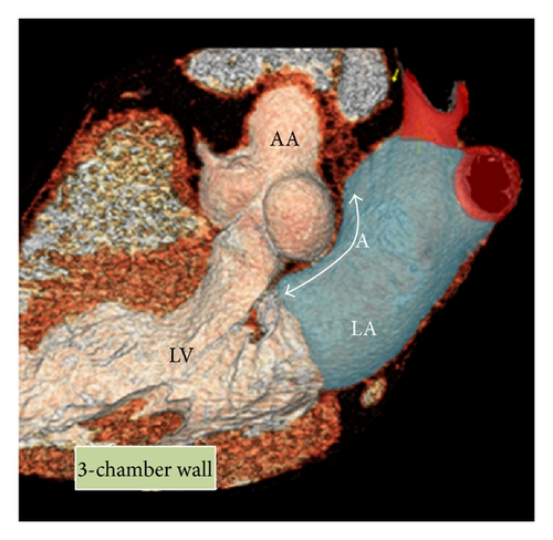 Details are in the caption following the image