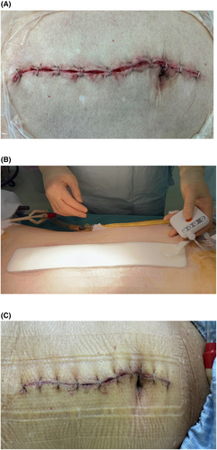 Details are in the caption following the image Details are in the caption following the image