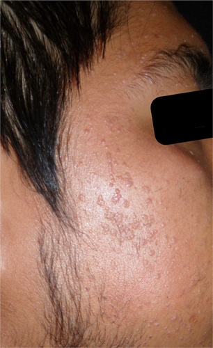 Details are in the caption following the image Details are in the caption following the image
