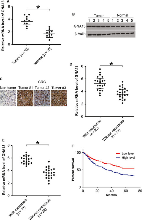 Retracted: GNA13 promotes tumor growth and angiogenesis by upregulating CXC chemokines via the NF-κB signaling pathway in colorectal cancer cells