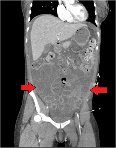 Details are in the caption following the image Details are in the caption following the image