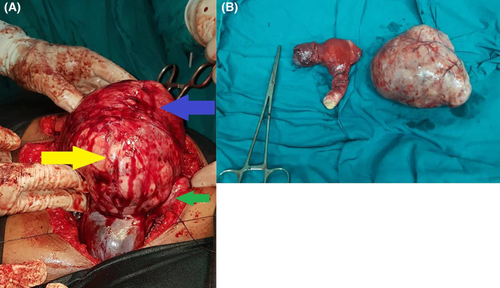 Details are in the caption following the image Details are in the caption following the image
