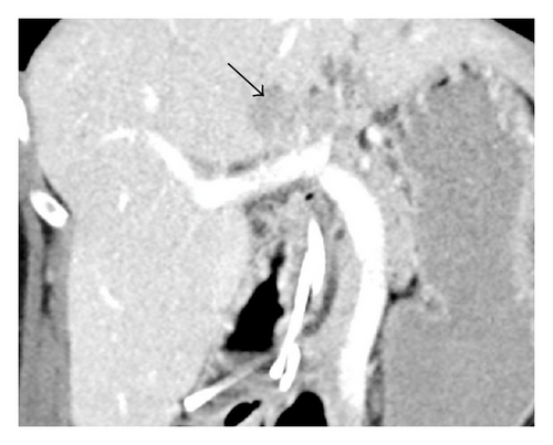Details are in the caption following the image