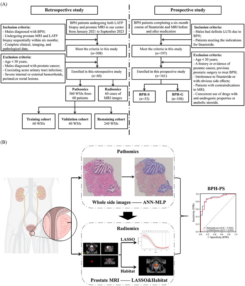 Predicting the pathological subdiagnosis of benign prostatic hyperplasia with MRI radiomics: A noninvasive approach