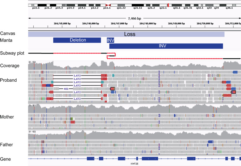 Genome sequencing identifies KMT2E-disrupting cryptic structural variant in a female with O'Donnell-Luria-Rodan syndrome
