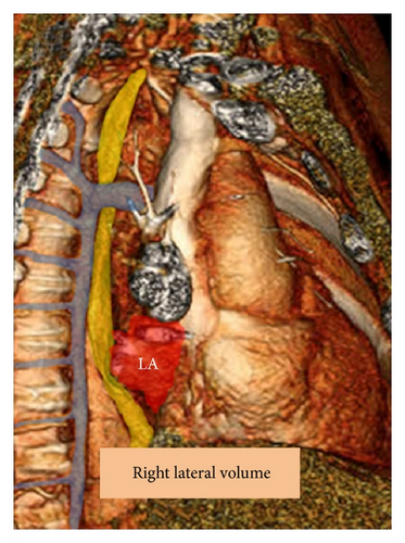 Details are in the caption following the image