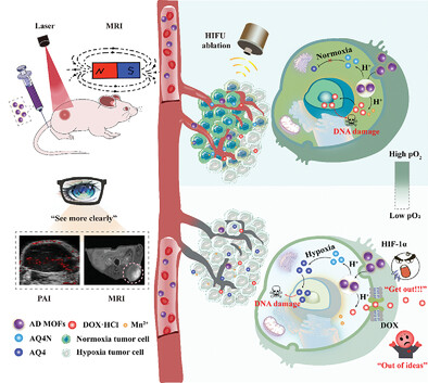 Metal-Organic Framework-Mediated Synergistic Hypoxia-Activated Chemo-Immunotherapy Induced by High Intensity Focused Ultrasound for Enhanced Cancer Theranostics