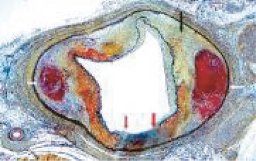 Details are in the caption following the image