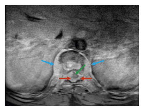 Details are in the caption following the image