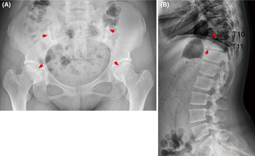 Details are in the caption following the image Details are in the caption following the image