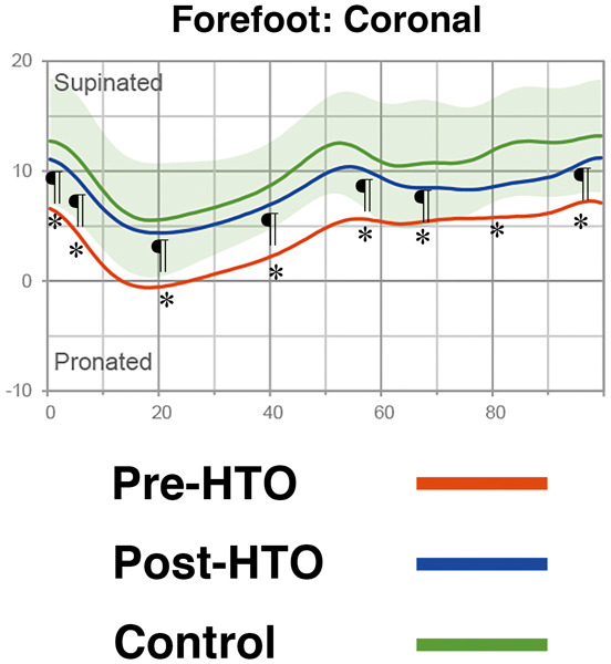 Change in intersegmental foot and ankle motion after a high tibial osteotomy in genu varum patients