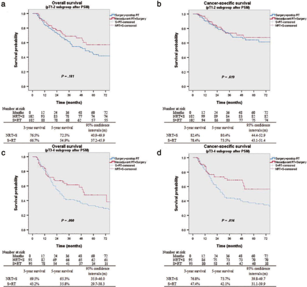 Role of radiation therapy in node-negative esophageal cancer: A propensity-matched analysis