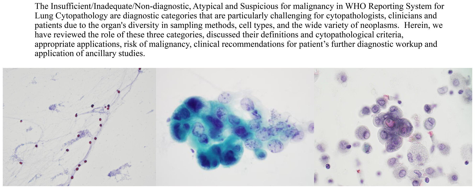 WHO Reporting System for Lung Cytopathology: Insights Into the Insufficient/Inadequate/Non-Diagnostic, Atypical and Suspicious for Malignancy Categories and How to Use Them