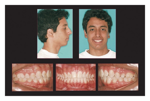 Details are in the caption following the image Details are in the caption following the image