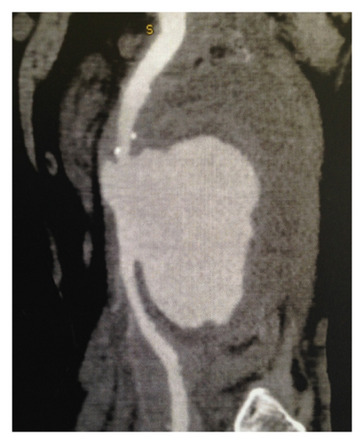 Details are in the caption following the image