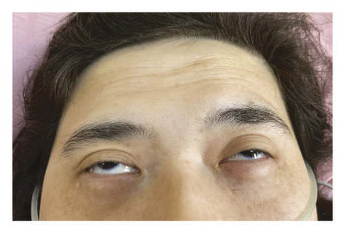 Details are in the caption following the image Details are in the caption following the image