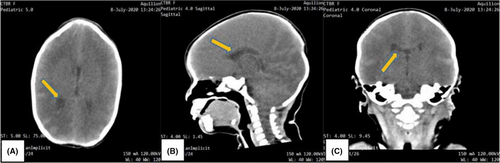 Details are in the caption following the image
