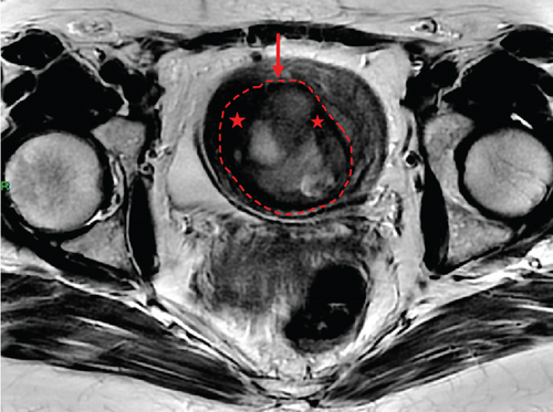 Details are in the caption following the image Details are in the caption following the image