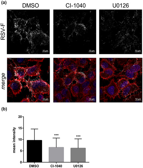 Late activation of the Raf/MEK/ERK pathway is required for translocation of the respiratory syncytial virus F protein to the plasma membrane and efficient viral replication