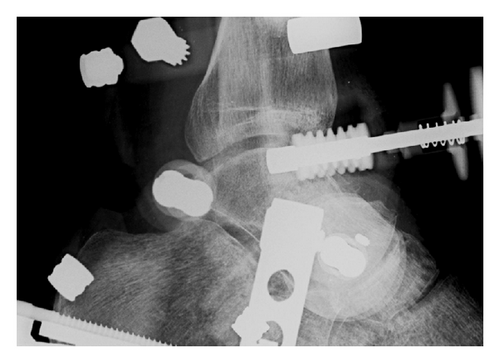 Details are in the caption following the image Details are in the caption following the image