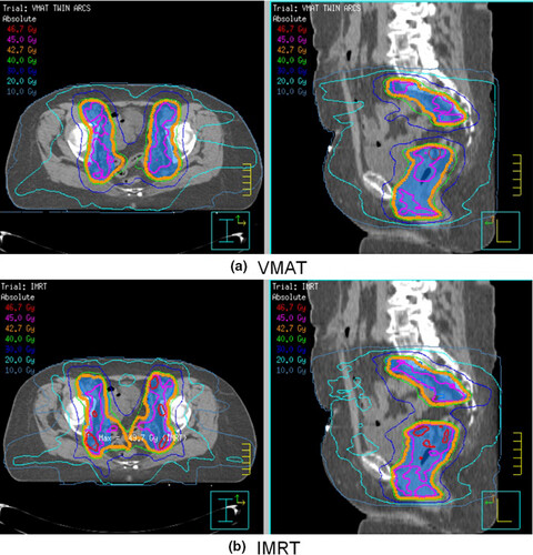 The role of volumetric modulated arc therapy (VMAT) in gynaecological radiation therapy: A dosimetric comparison of intensity modulated radiation therapy versus VMAT