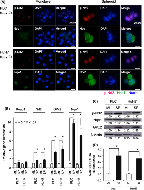 Modulation of Nqo1 activity intercepts anoikis resistance and reduces metastatic potential of hepatocellular carcinoma