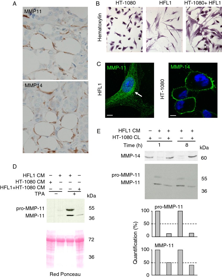 Functional relationship between matrix metalloproteinase-11 and matrix metalloproteinase-14