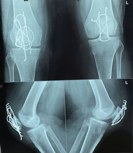 Details are in the caption following the image