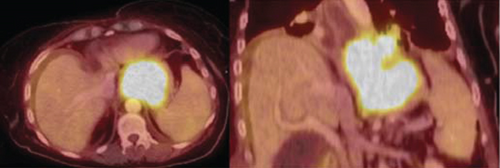 Details are in the caption following the image
